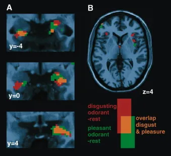 fMRI brain scan showing disgust response